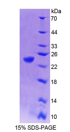 PTP4A1 / PRL-1 Protein - Recombinant Protein Tyrosine Phosphatase Type IVA 1 (PTP4A1) by SDS-PAGE