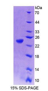 PTP4A1 / PRL-1 Protein - Recombinant Protein Tyrosine Phosphatase Type IVA 1 (PTP4A1) by SDS-PAGE