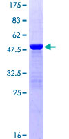 PTP4A2 / PRL-2 Protein - 12.5% SDS-PAGE of human PTP4A2 stained with Coomassie Blue