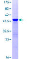 PTP4A2 / PRL-2 Protein - 12.5% SDS-PAGE of human PTP4A2 stained with Coomassie Blue