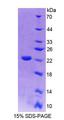 PTP4A2 / PRL-2 Protein - Recombinant Protein Tyrosine Phosphatase Type IVA 2 (PTP4A2) by SDS-PAGE