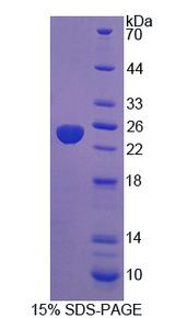 PTP4A3 Protein - Recombinant Protein Tyrosine Phosphatase Type IVA 3 By SDS-PAGE