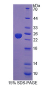 PTP4A3 Protein - Recombinant Protein Tyrosine Phosphatase Type IVA 3 By SDS-PAGE