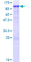 PTPDC1 Protein - 12.5% SDS-PAGE of human PTPDC1 stained with Coomassie Blue