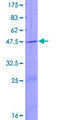 PTPMT1 Protein - 12.5% SDS-PAGE of human PTPMT1 stained with Coomassie Blue