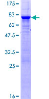 PTPN2 / TC-PTP Protein - 12.5% SDS-PAGE of human PTPN2 stained with Coomassie Blue