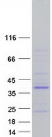 PTPN20 Protein - Purified recombinant protein PTPN20 was analyzed by SDS-PAGE gel and Coomassie Blue Staining