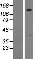 PTPN21 / PTPD1 Protein - Western validation with an anti-DDK antibody * L: Control HEK293 lysate R: Over-expression lysate