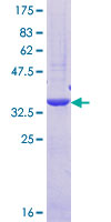 PTPN23 / HDPTP Protein - 12.5% SDS-PAGE Stained with Coomassie Blue.