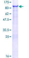 PTPN5 / STEP Protein - 12.5% SDS-PAGE of human PTPN5 stained with Coomassie Blue