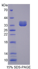 PTPN6 / SHP1 Protein - Recombinant Protein Tyrosine Phosphatase, Non Receptor Type 6 By SDS-PAGE