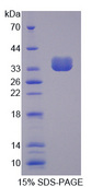 PTPN6 / SHP1 Protein - Recombinant Protein Tyrosine Phosphatase, Non Receptor Type 6 By SDS-PAGE