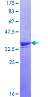 PTPN7 / HEPTP Protein - 12.5% SDS-PAGE Stained with Coomassie Blue.