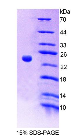 PTPRA / RPTP-Alpha Protein - Recombinant Protein Tyrosine Phosphatase Receptor Type A (PTPRA) by SDS-PAGE