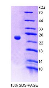 PTPRA / RPTP-Alpha Protein - Recombinant Protein Tyrosine Phosphatase Receptor Type A (PTPRA) by SDS-PAGE