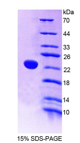 PTPRE / PTP Epsilon Protein - Recombinant Protein Tyrosine Phosphatase Receptor Type E (PTPRE) by SDS-PAGE
