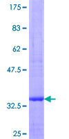 PTPRG / RPTR-Gamma Protein - 12.5% SDS-PAGE of human PTPRG stained with Coomassie Blue