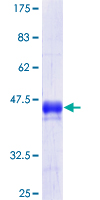 PTPRJ / CD148 Protein - 12.5% SDS-PAGE Stained with Coomassie Blue.