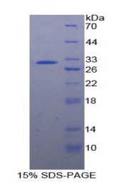 PTPRJ / CD148 Protein - Recombinant Protein Tyrosine Phosphatase Receptor Type J By SDS-PAGE