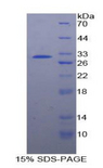 PTPRJ / CD148 Protein - Recombinant Protein Tyrosine Phosphatase Receptor Type J By SDS-PAGE