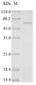 PTPRN / IA-2 Protein - (Tris-Glycine gel) Discontinuous SDS-PAGE (reduced) with 5% enrichment gel and 15% separation gel.