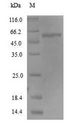 PTPRN / IA-2 Protein - (Tris-Glycine gel) Discontinuous SDS-PAGE (reduced) with 5% enrichment gel and 15% separation gel.