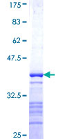 PTPRN / IA-2 Protein - 12.5% SDS-PAGE Stained with Coomassie Blue.