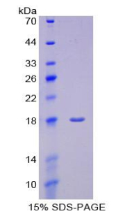 PTPRN / IA-2 Protein