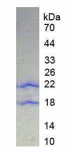 PTPRN / IA-2 Protein - Recombinant Protein Tyrosine Phosphatase Receptor Type N By SDS-PAGE