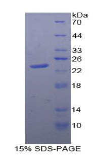 PTPRN / IA-2 Protein - Recombinant Protein Tyrosine Phosphatase Receptor Type N By SDS-PAGE