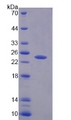 PTPRN2 / Phogrin Protein - Recombinant Protein Tyrosine Phosphatase Receptor Type N2 (PTPRN2) by SDS-PAGE