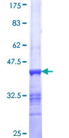 PTPRN2 / Phogrin Protein - 12.5% SDS-PAGE Stained with Coomassie Blue.