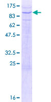 PTPRR Protein - 12.5% SDS-PAGE of human PTPRR stained with Coomassie Blue