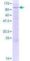 PTPRR Protein - 12.5% SDS-PAGE of human PTPRR stained with Coomassie Blue