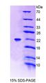 PTPRZ1 / Phosphacan Protein - Recombinant Protein Tyrosine Phosphatase Receptor Type Z (PTPRZ) by SDS-PAGE