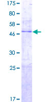 PTRH1 Protein - 12.5% SDS-PAGE of human PTRH1 stained with Coomassie Blue