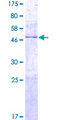 PTRH1 Protein - 12.5% SDS-PAGE of human PTRH1 stained with Coomassie Blue