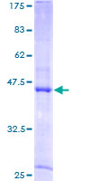 PTRH2 / BIT1 Protein - 12.5% SDS-PAGE of human Bit1 stained with Coomassie Blue
