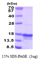PTRHD1 / C2orf79 Protein