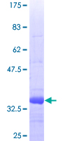PTX3 / Pentraxin 3 Protein - 12.5% SDS-PAGE Stained with Coomassie Blue.
