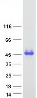 PTX3 / Pentraxin 3 Protein - Purified recombinant protein PTX3 was analyzed by SDS-PAGE gel and Coomassie Blue Staining