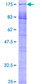 PUF60 Protein - 12.5% SDS-PAGE of human SIAHBP1 stained with Coomassie Blue