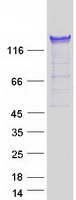 PUM1 Protein - Purified recombinant protein PUM1 was analyzed by SDS-PAGE gel and Coomassie Blue Staining