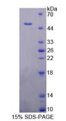PUS1 Protein - Recombinant Pseudouridylate Synthase 1 By SDS-PAGE