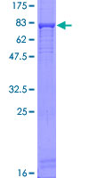 PUS3 Protein - 12.5% SDS-PAGE of human PUS3 stained with Coomassie Blue