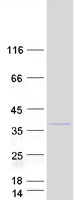 PUSL1 Protein - Purified recombinant protein PUSL1 was analyzed by SDS-PAGE gel and Coomassie Blue Staining