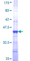 PV1 / PLVAP Protein - 12.5% SDS-PAGE Stained with Coomassie Blue.