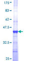 PV1 / PLVAP Protein - 12.5% SDS-PAGE Stained with Coomassie Blue.