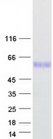 PV1 / PLVAP Protein - Purified recombinant protein PLVAP was analyzed by SDS-PAGE gel and Coomassie Blue Staining
