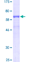 PVR / CD155 Protein - 12.5% SDS-PAGE of human PVR stained with Coomassie Blue